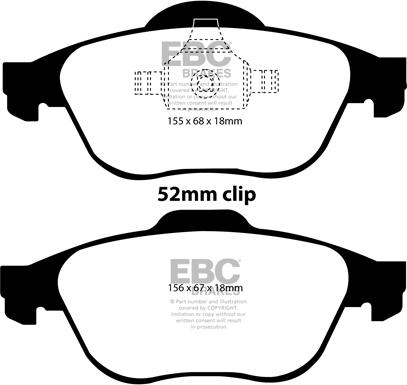 EBC Brakes DP41394R - Комплект спирачно феродо, дискови спирачки vvparts.bg
